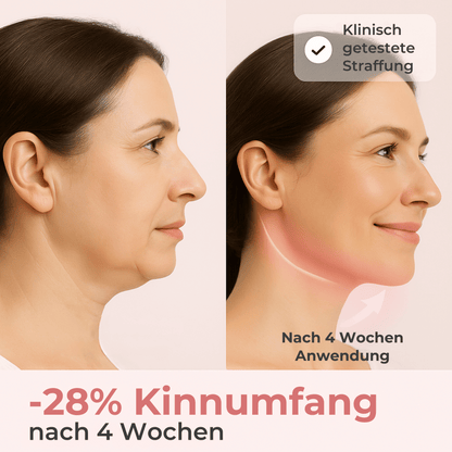 MyraLift™ – Ohne OP zum strafferen Kinn