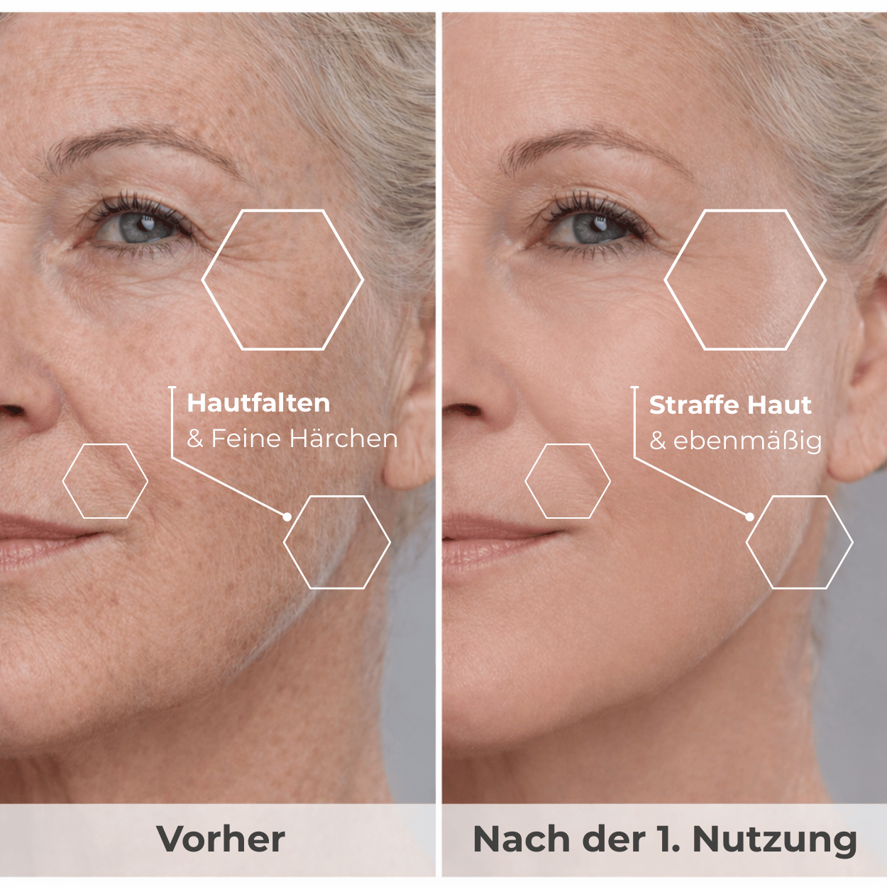 Dermaplaning – Glatte & Straffe Haut in 5 Minuten mit RemoveRazer